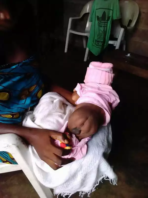 Mother laments After Giving Birth to a Baby Without Anus In Delta State (Graphic Photos)